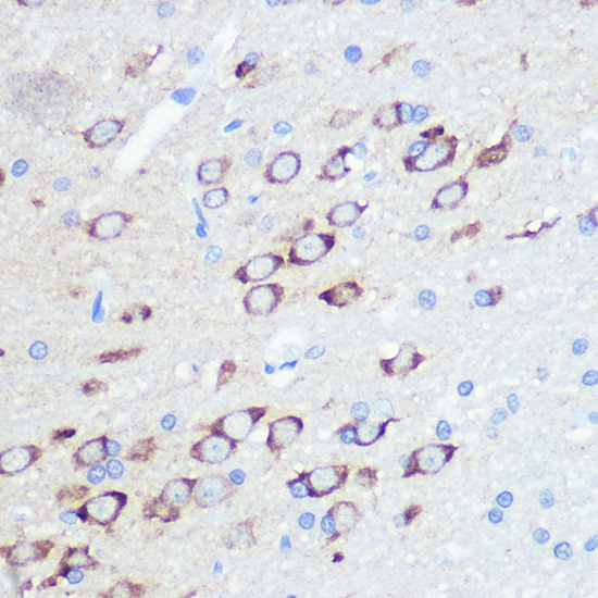 GluR2/GRIA2 Rabbit mAb