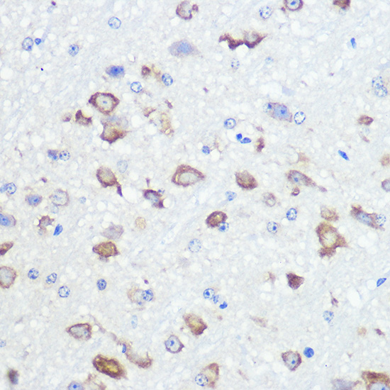 GluR2/GRIA2 Rabbit mAb
