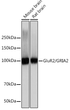 GluR2/GRIA2 Rabbit mAb