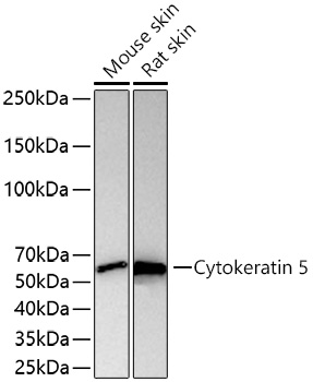 Cytokeratin 5 Rabbit mAb