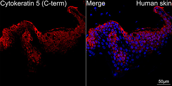 Cytokeratin 5 Rabbit mAb