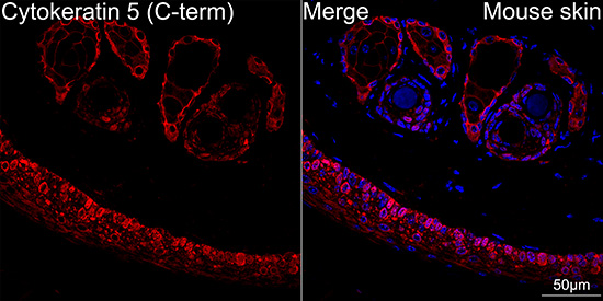 Cytokeratin 5 Rabbit mAb