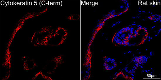 Cytokeratin 5 Rabbit mAb