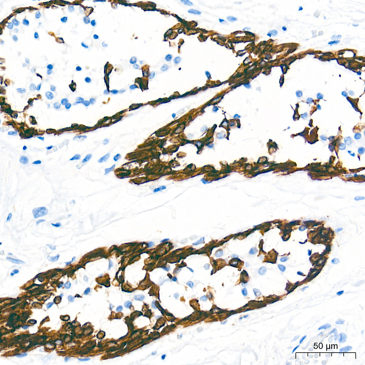 Cytokeratin 5 Rabbit mAb