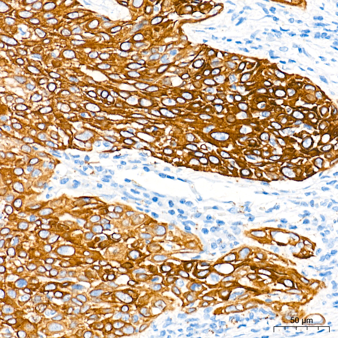 Cytokeratin 5 Rabbit mAb