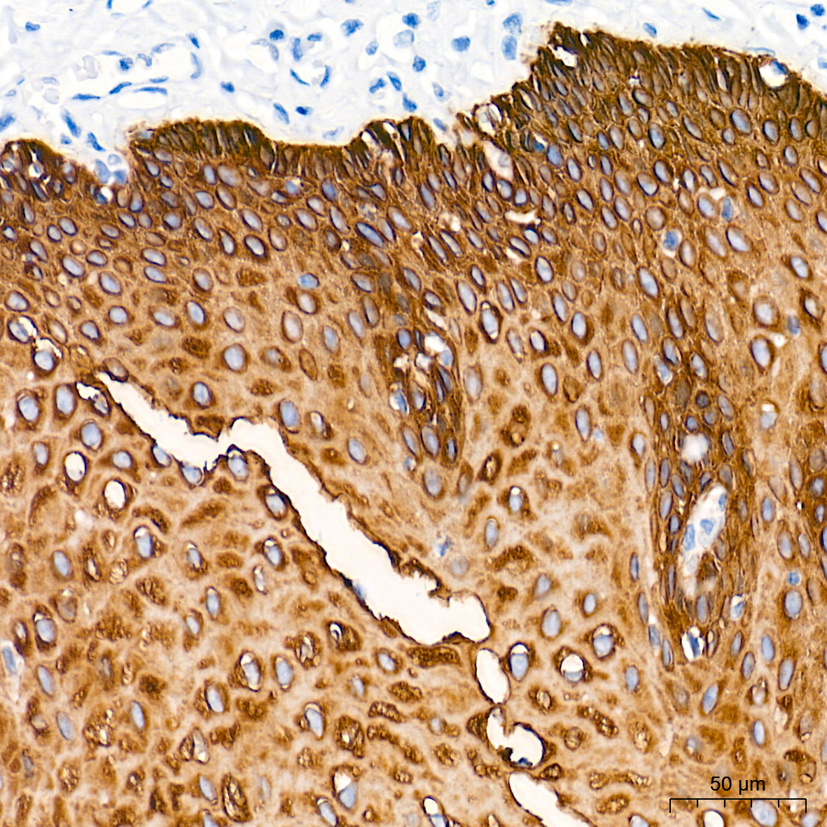 Cytokeratin 5 Rabbit mAb