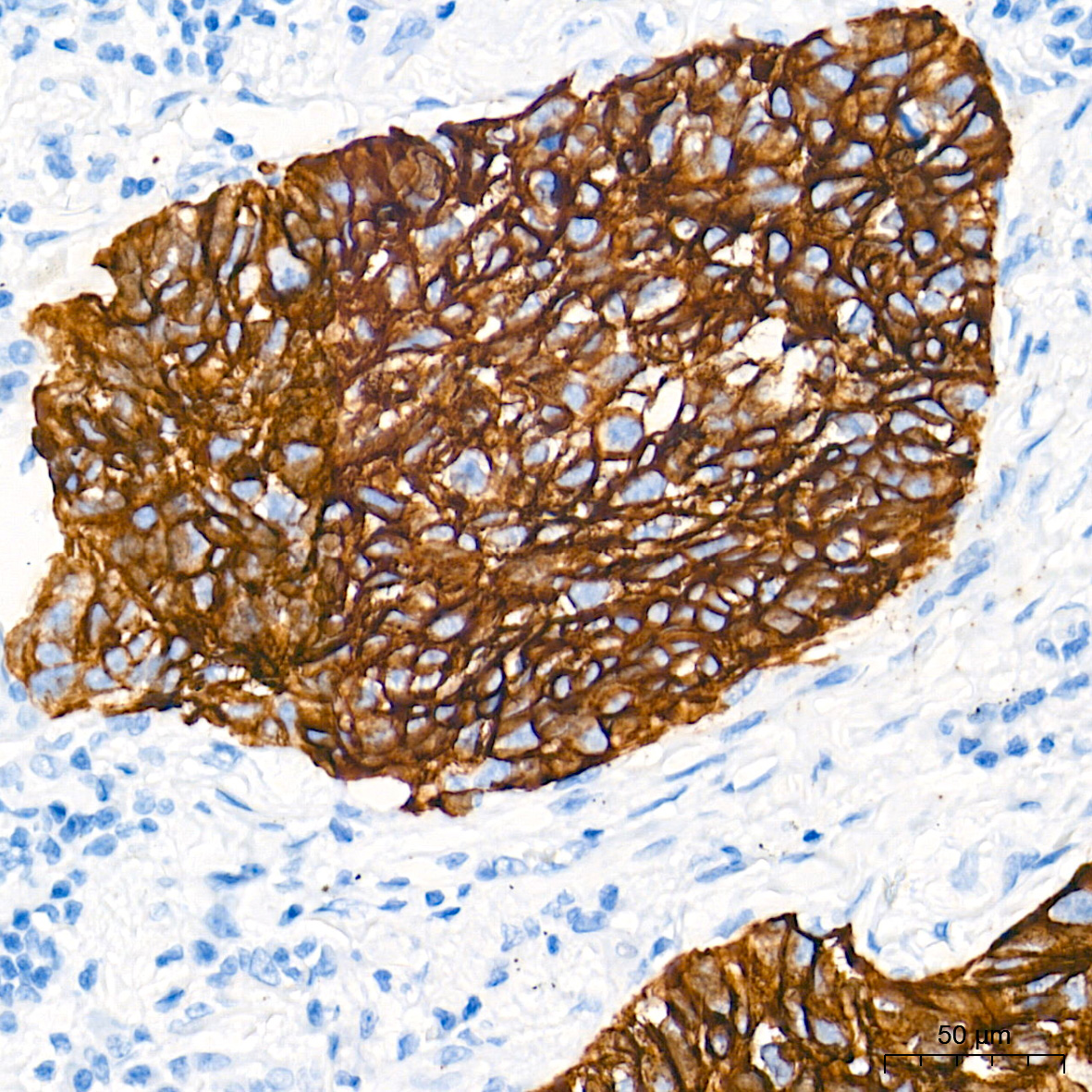 Cytokeratin 5 Rabbit mAb