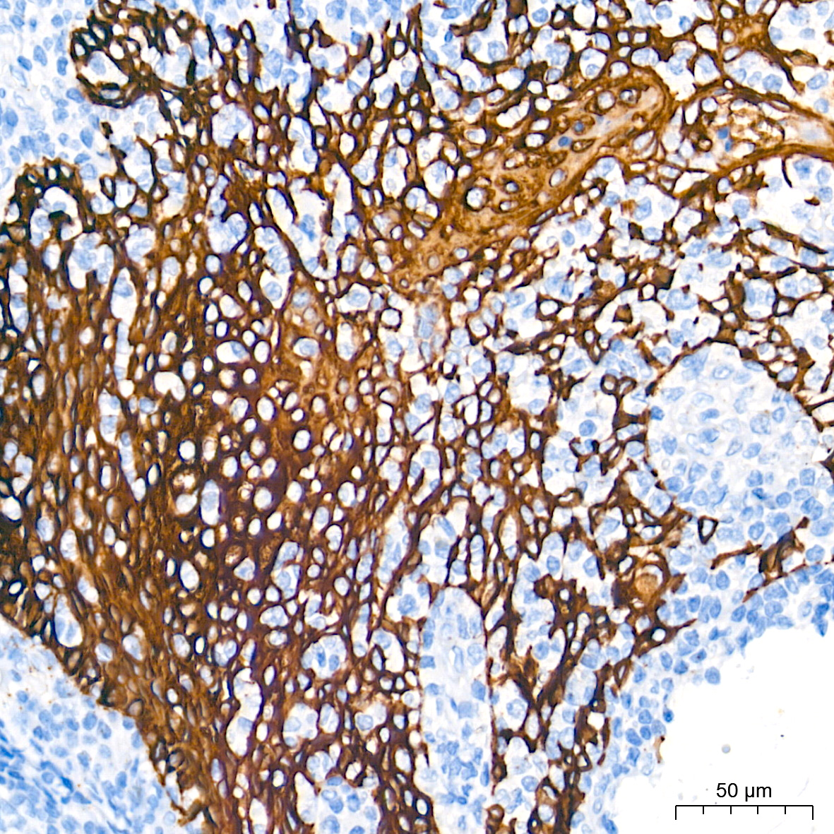 Cytokeratin 5 Rabbit mAb