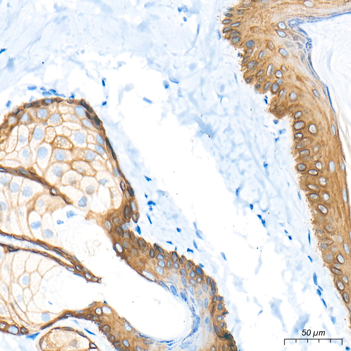 Cytokeratin 5 Rabbit mAb