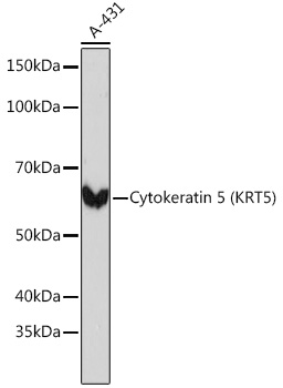 Cytokeratin 5 Rabbit mAb