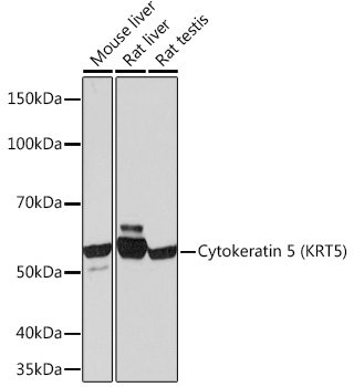 Cytokeratin 5 Rabbit mAb