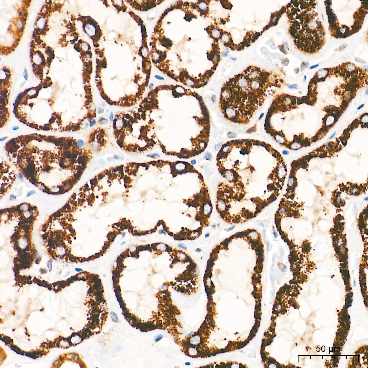 GM130 Rabbit mAb