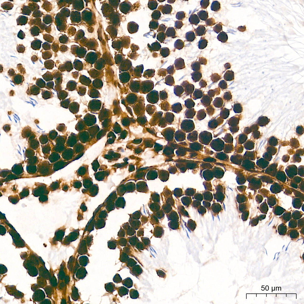 Histone H2AX Rabbit mAb