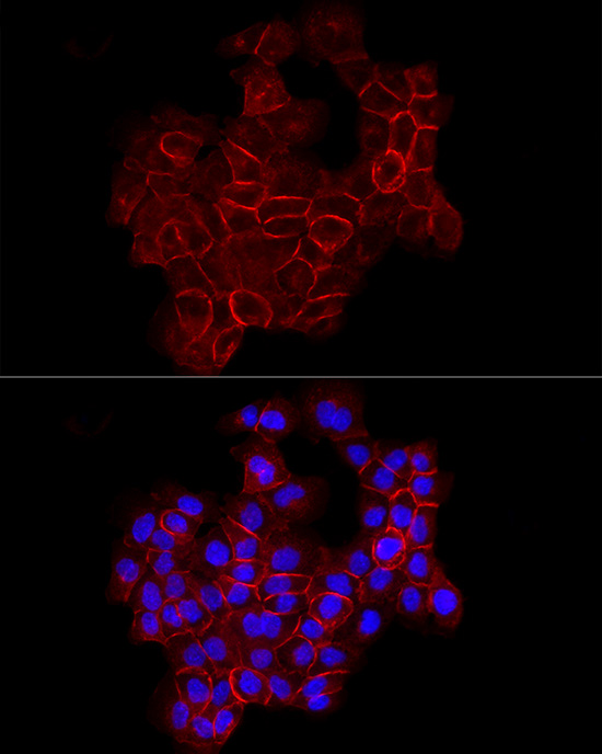 E-Cadherin Rabbit pAb