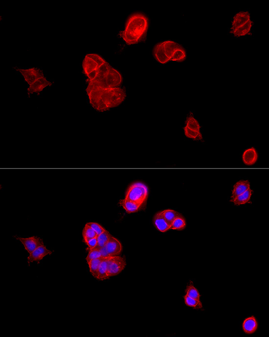 E-Cadherin Rabbit pAb