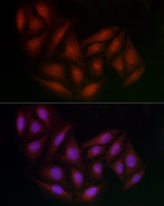BRCA1 Rabbit pAb