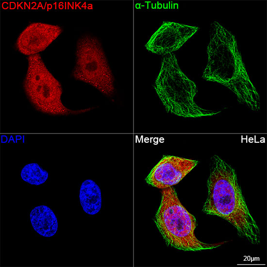 [KO Validated] CDKN2A/p16INK4a Rabbit mAb