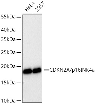 [KO Validated] CDKN2A/p16INK4a Rabbit mAb