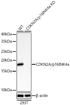 [KO Validated] CDKN2A/p16INK4a Rabbit mAb