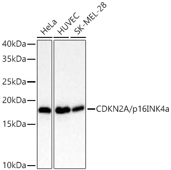[KO Validated] CDKN2A/p16INK4a Rabbit mAb