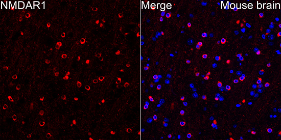 NMDAR1 Rabbit mAb