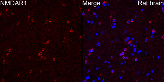 NMDAR1 Rabbit mAb