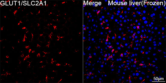 GLUT1/SLC2A1 Rabbit mAb