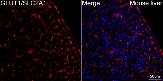GLUT1/SLC2A1 Rabbit mAb