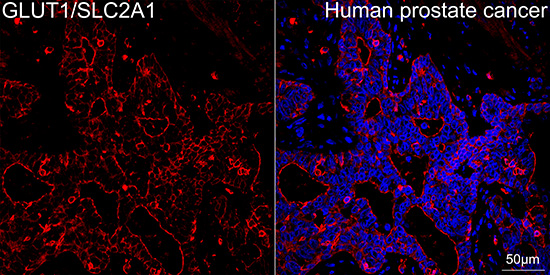 GLUT1/SLC2A1 Rabbit mAb