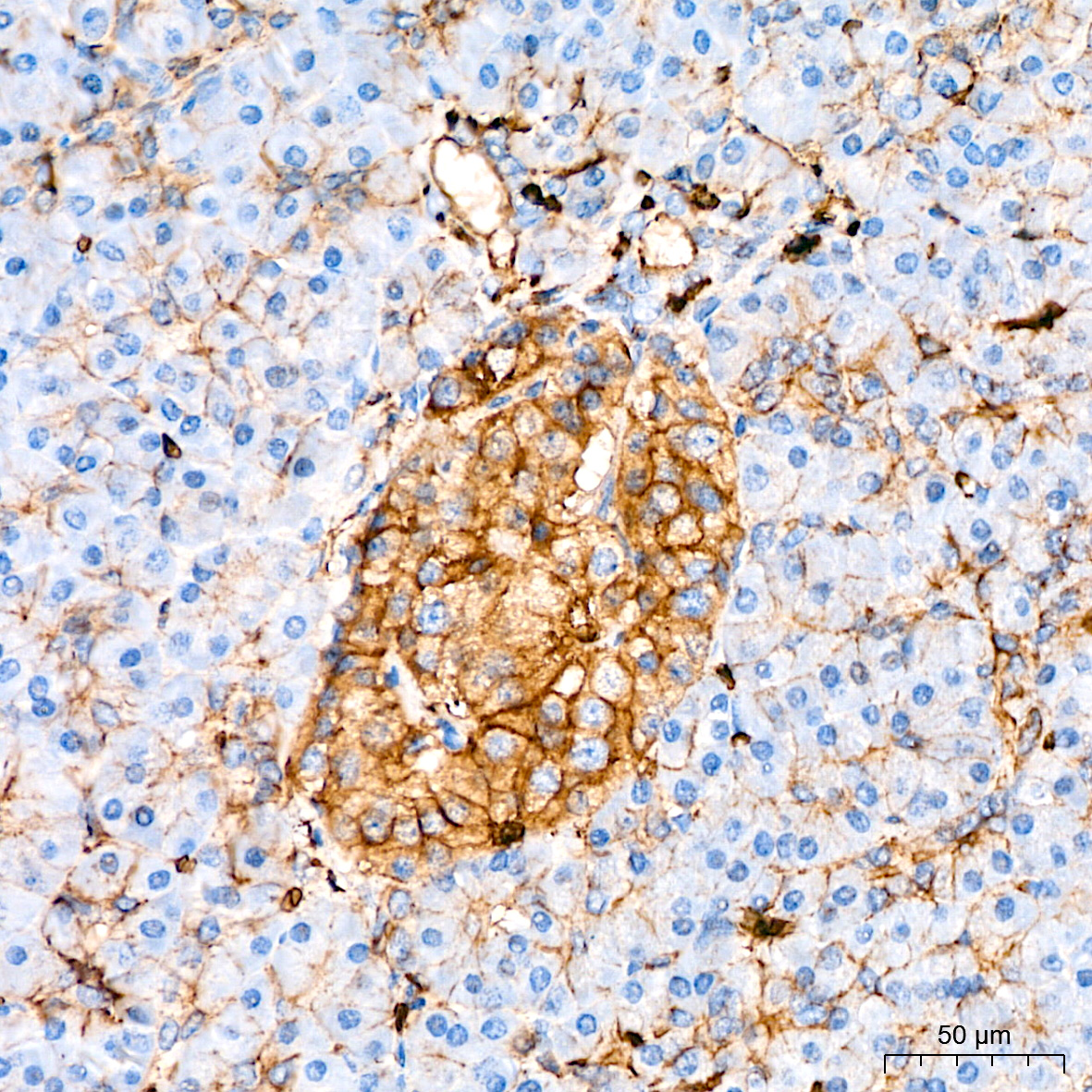 GLUT1/SLC2A1 Rabbit mAb