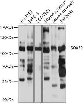 Western blot - SOX30 Rabbit pAb (A11759)