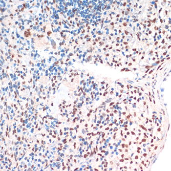TDP-43/TARDBP Rabbit pAb