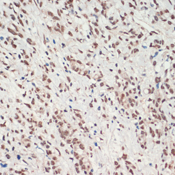TDP-43/TARDBP Rabbit pAb