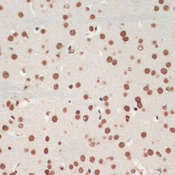 TDP-43/TARDBP Rabbit pAb