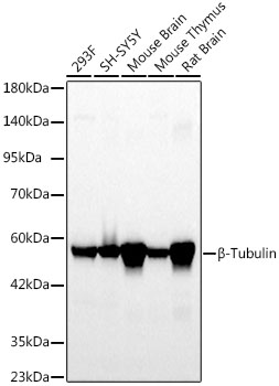 β-Tubulin Rabbit mAb
