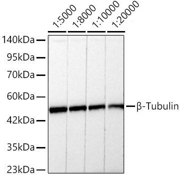 β-Tubulin Rabbit mAb