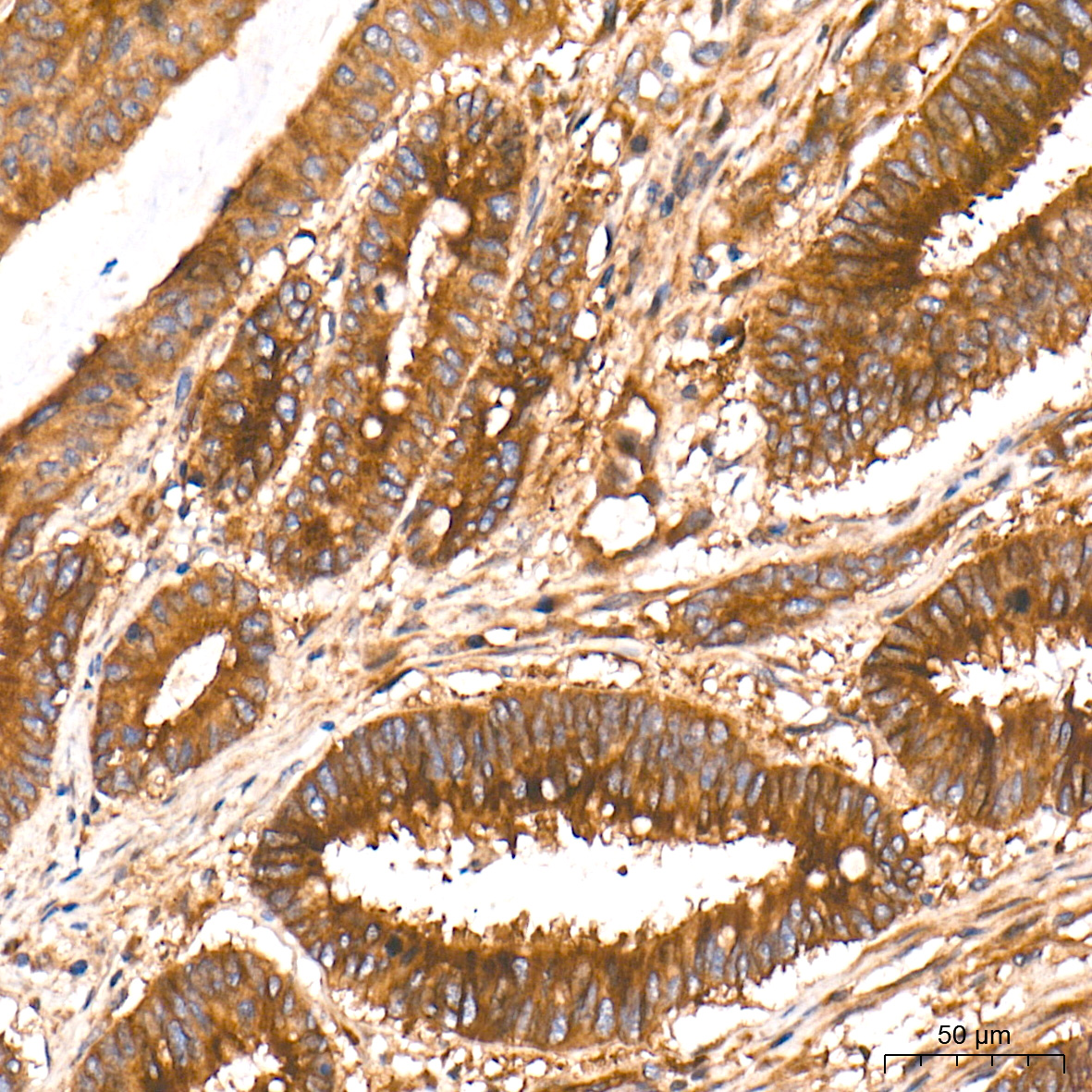 β-Tubulin Rabbit mAb