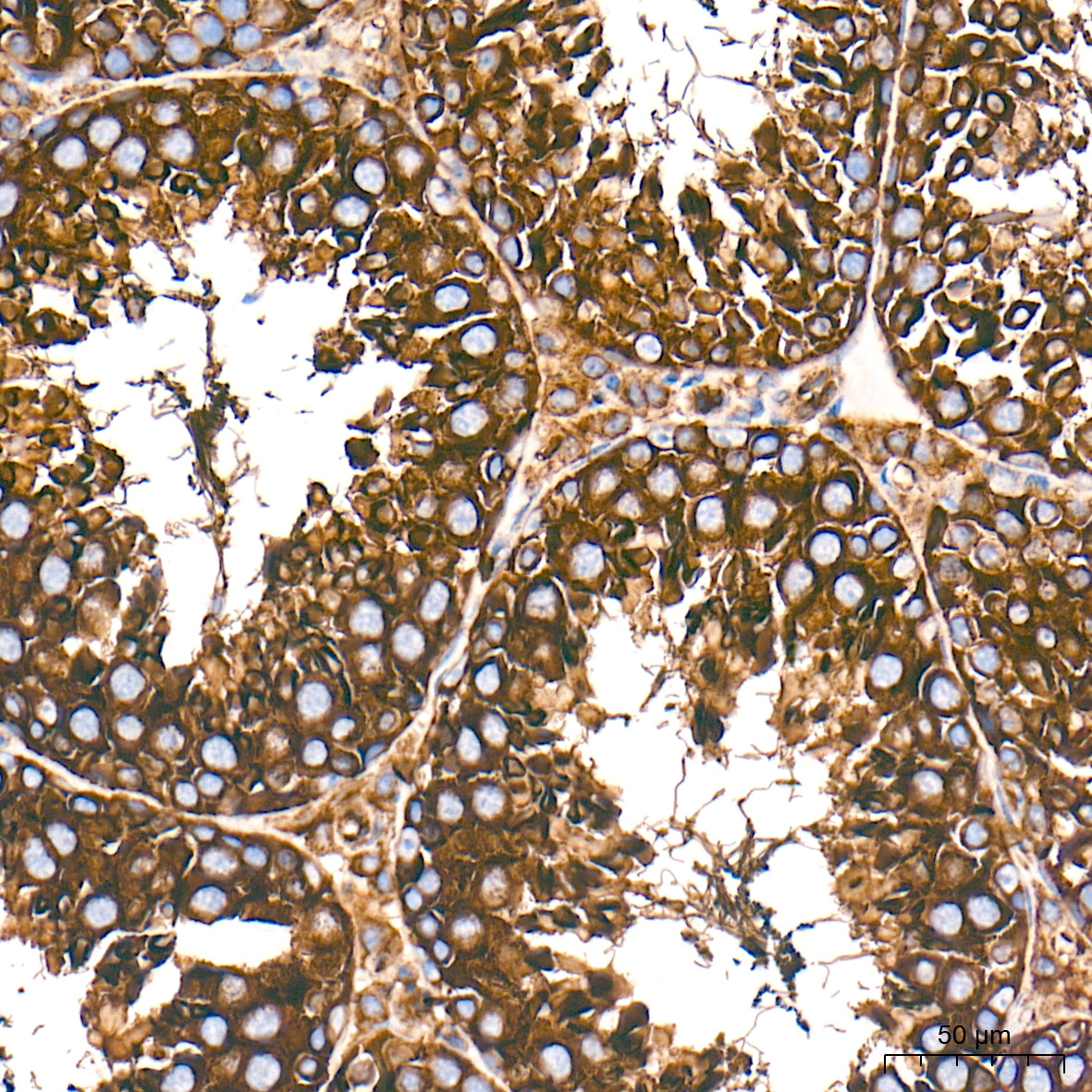 β-Tubulin Rabbit mAb
