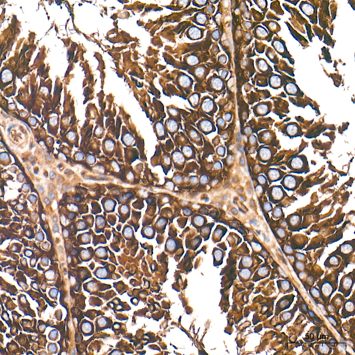 β-Tubulin Rabbit mAb