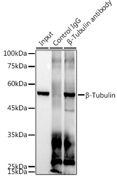β-Tubulin Rabbit mAb