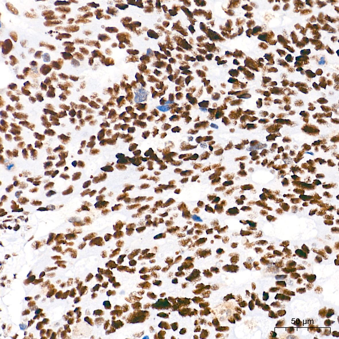 Ku80 Rabbit mAb