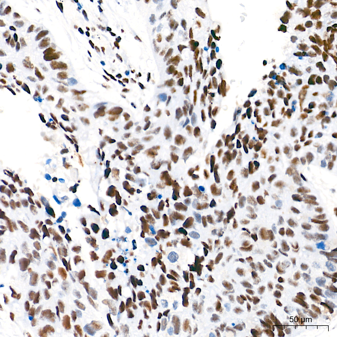 Ku80 Rabbit mAb