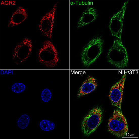 AGR2 Rabbit mAb