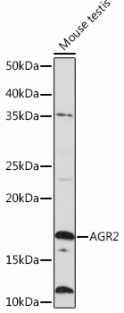 AGR2 Rabbit mAb