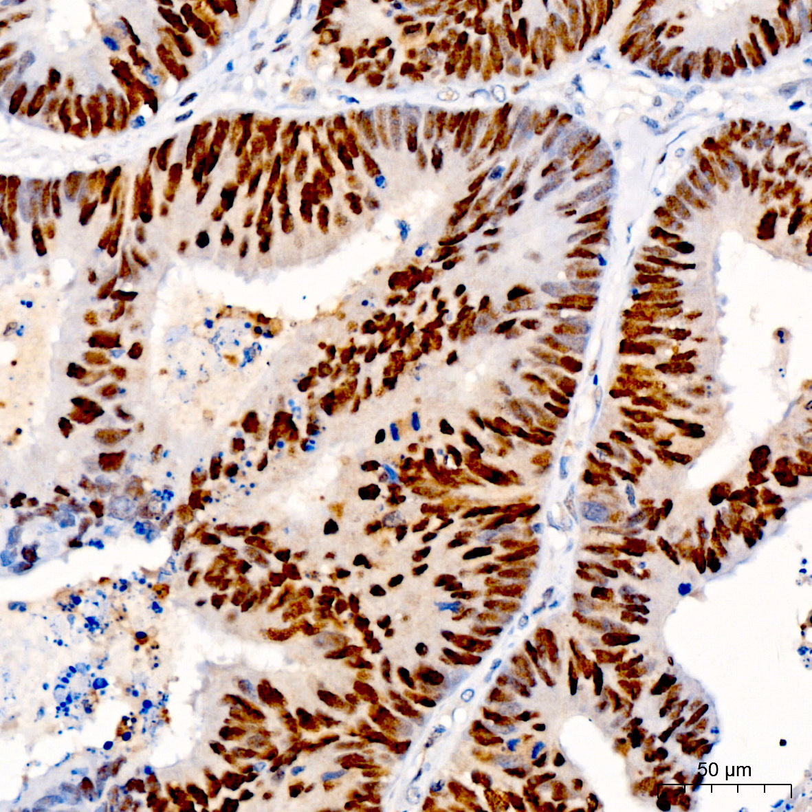 PCNA Rabbit mAb