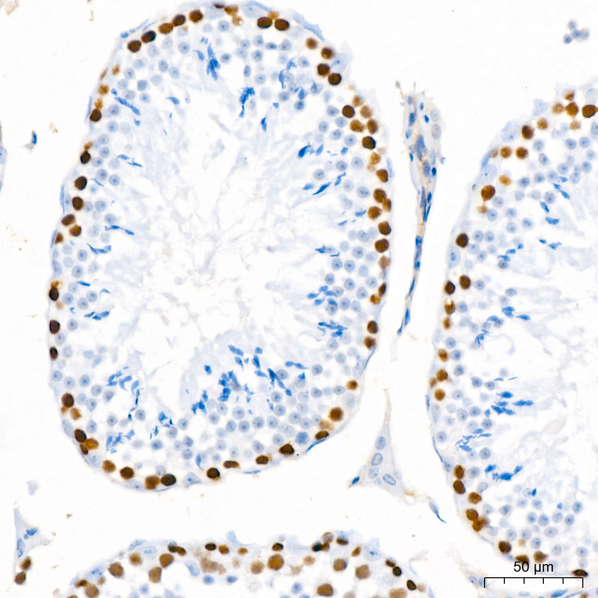PCNA Rabbit mAb