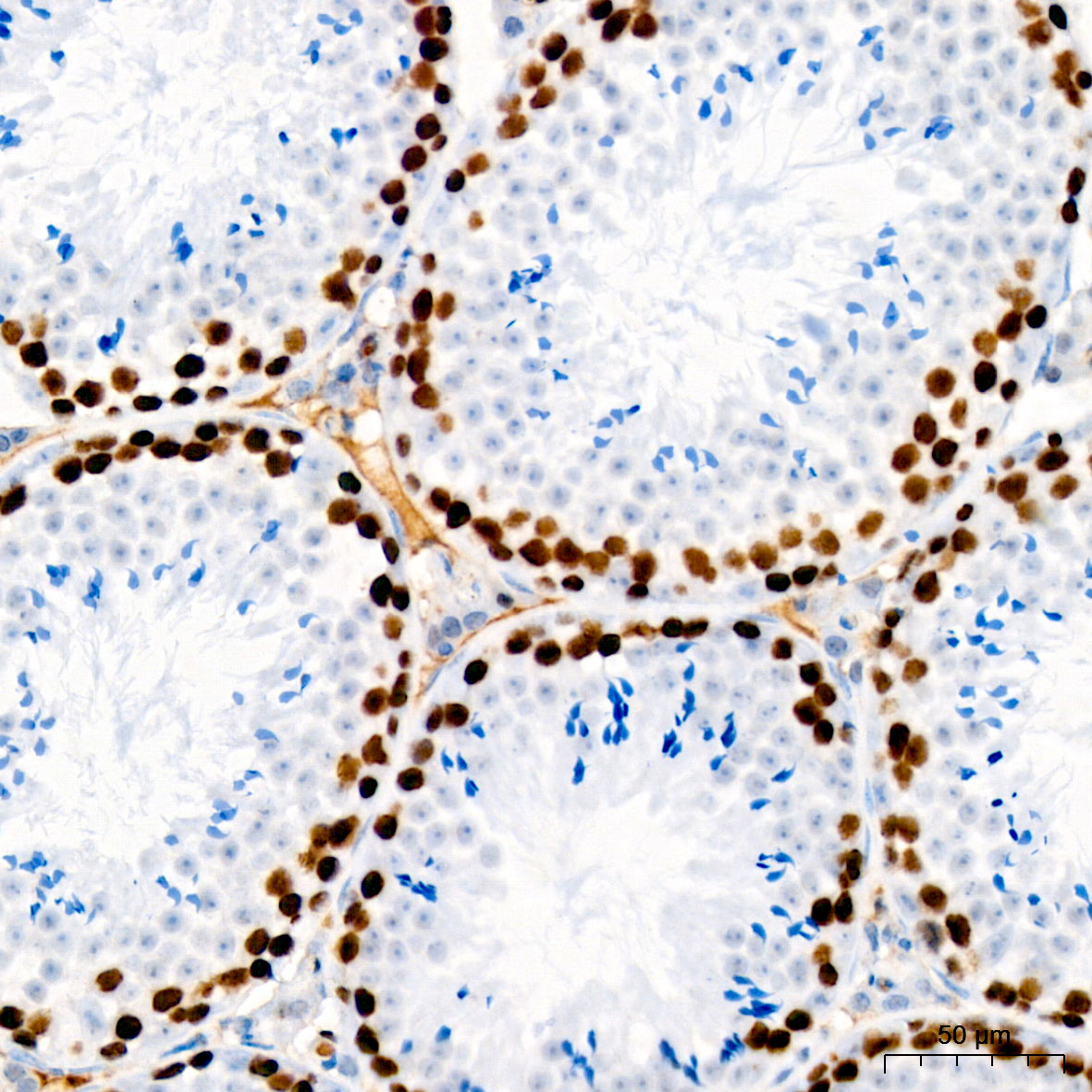 PCNA Rabbit mAb