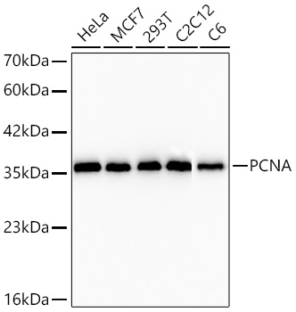 PCNA Rabbit mAb