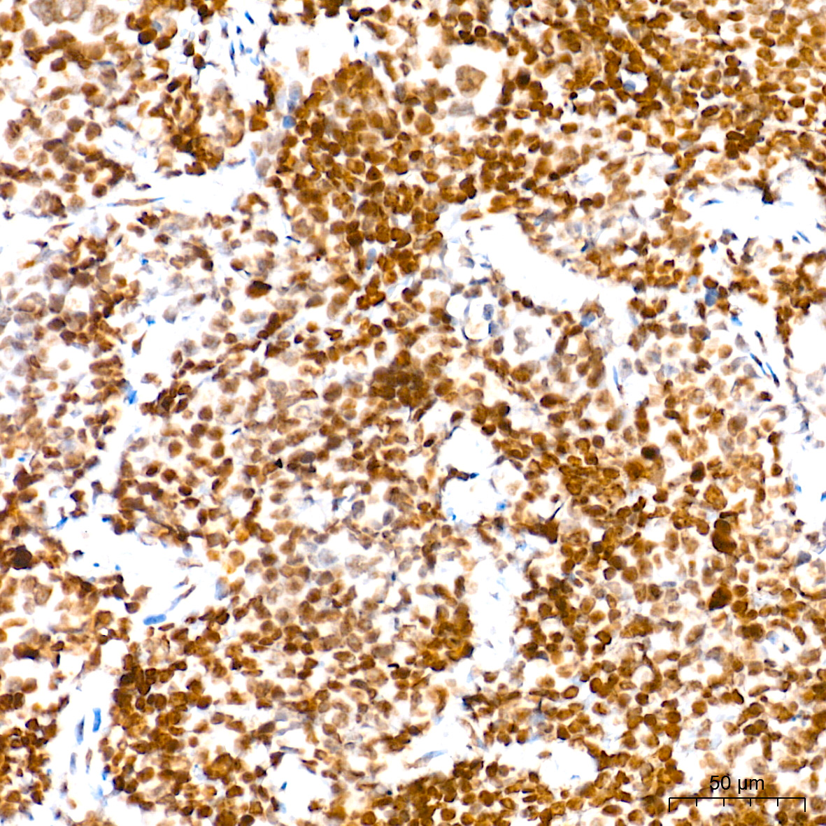 Histone H3 Rabbit mAb