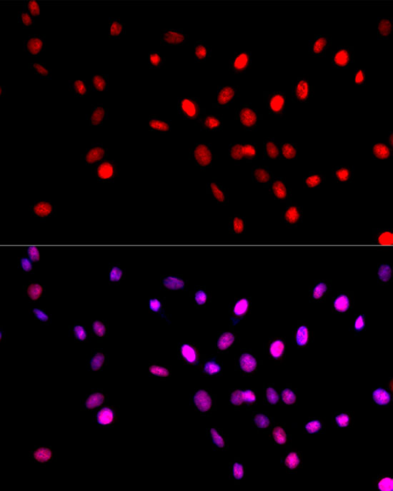 Histone H3 Rabbit mAb